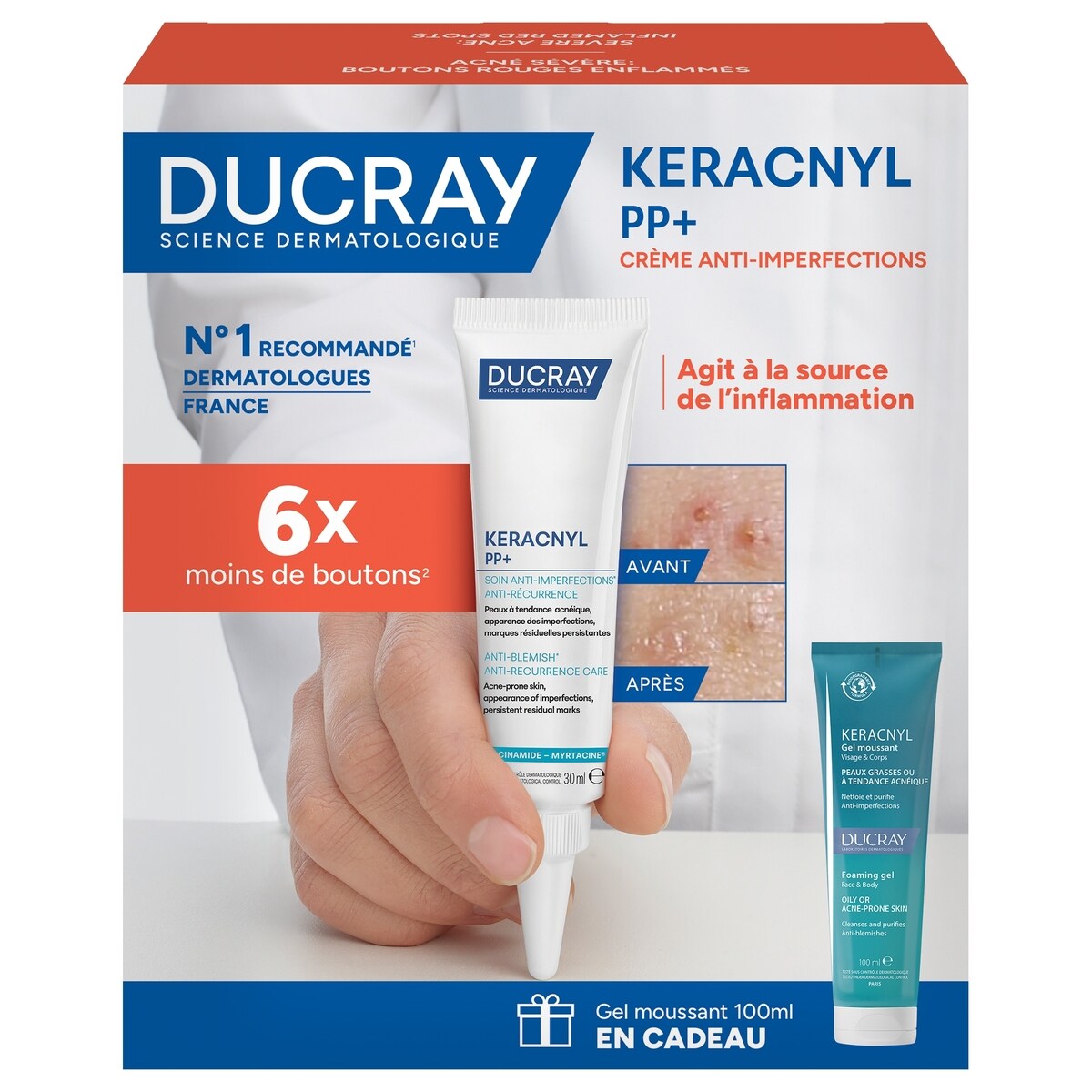Coffret Keracnyl PP+ Boutons rouges enflammés